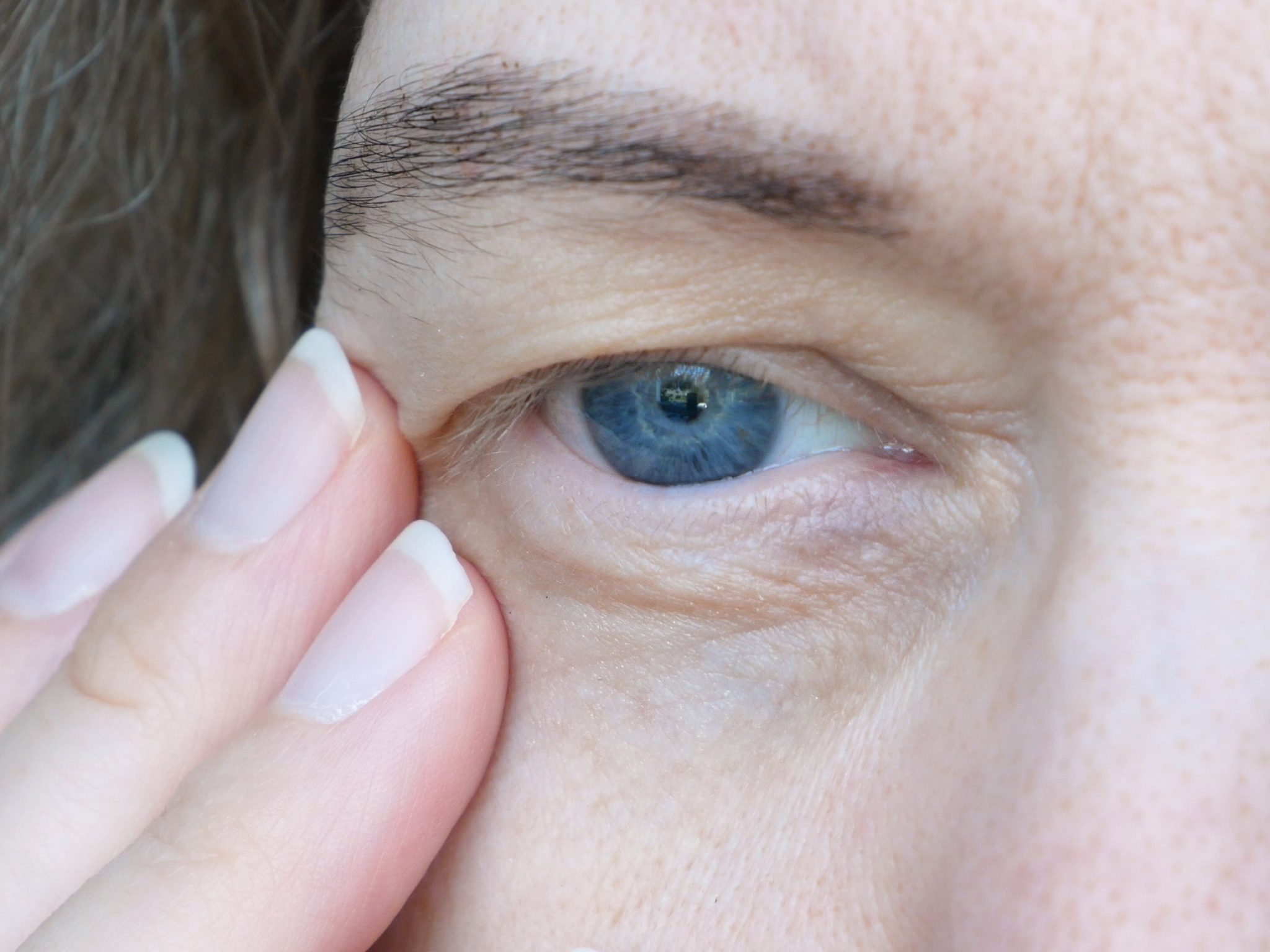 What Causes Droopy Eyes – sightconnection